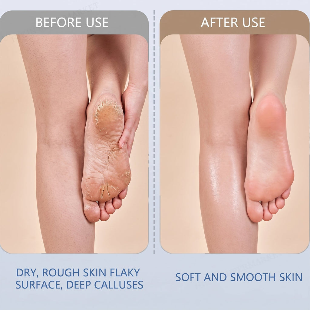 Electric Foot File