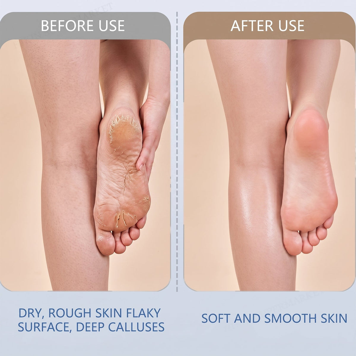 Electric Foot File